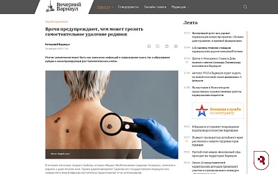 Эксперт СГМУ предупредила читателей «Вечернего Барнаула», почему нельзя самостоятельно удалять родинки