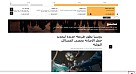 Арабский Sputnik рассказал об открытии учеными СГМУ новой диагностики конкрементов