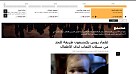 «Sputnik» рассказал о новых методах ученых СГМУ по борьбе с детским слюнотечением
