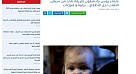«Press Bee» написал о новом методе ученых Саратовского медуниверситета в работе детской сиалореей